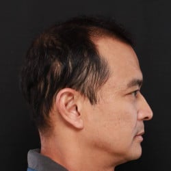 After Image