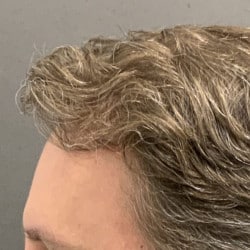After Image