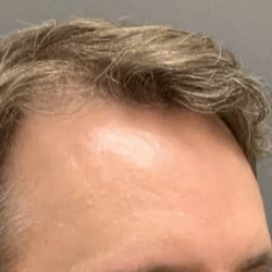 After Image