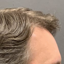After Image