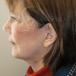 After Image