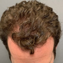 After Image
