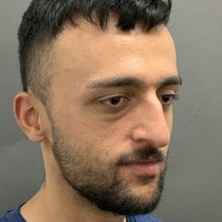 Before Image