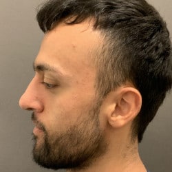 After Image