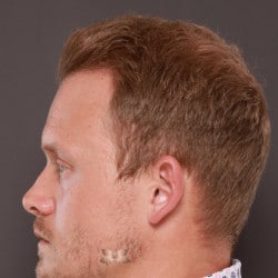 After Image