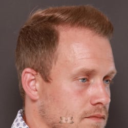After Image