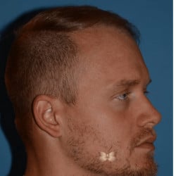 Before Image