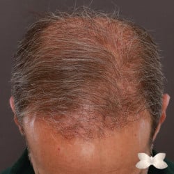 After Image