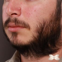 After Image