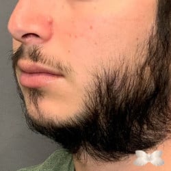 Before Image