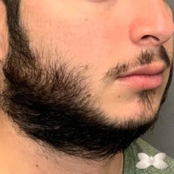 Before Image