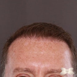 After Image