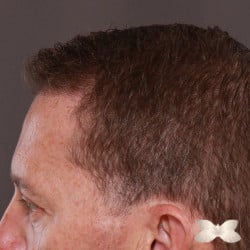 After Image