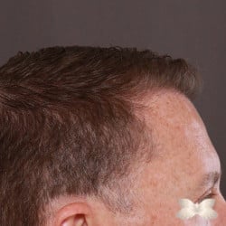 After Image