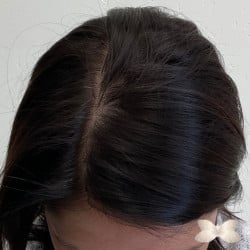 After Image