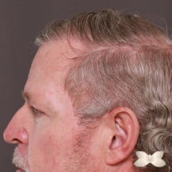 After Image