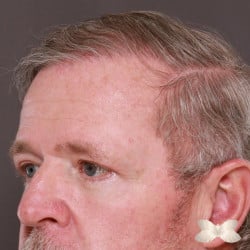 After Image