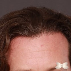 After Image
