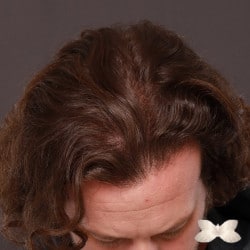 After Image