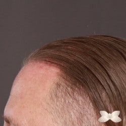 After Image