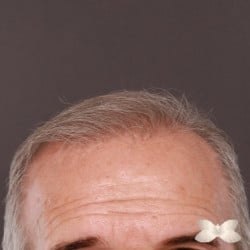 After Image