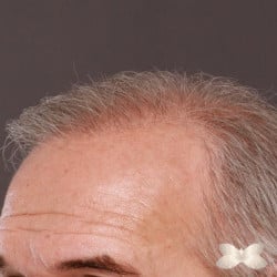 After Image