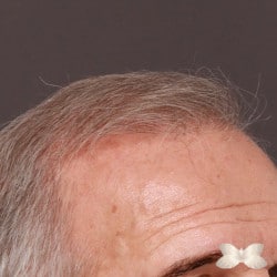 After Image