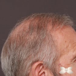 After Image