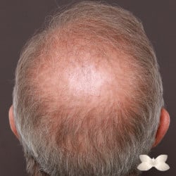 After Image