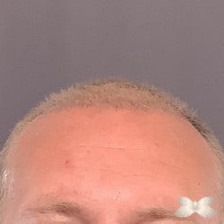 After Image