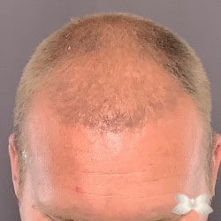 After Image