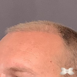 After Image