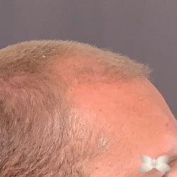 After Image