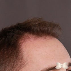 After Image