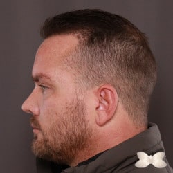 After Image