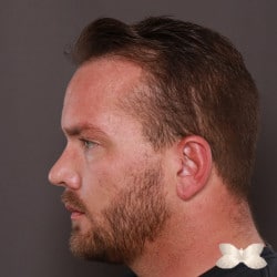 Before Image