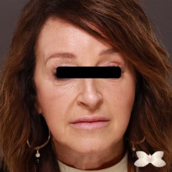 After Image