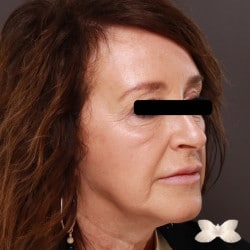 After Image