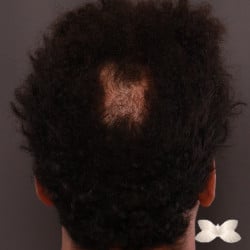 After Image