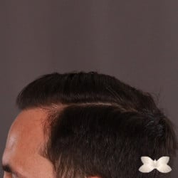 After Image