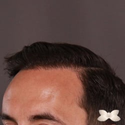After Image