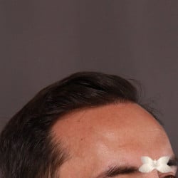 After Image