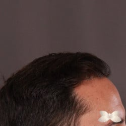 After Image