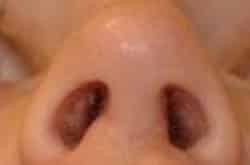 After Image