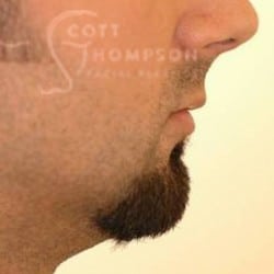 Before Image