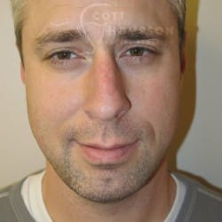 After Image