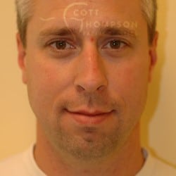 Before Image