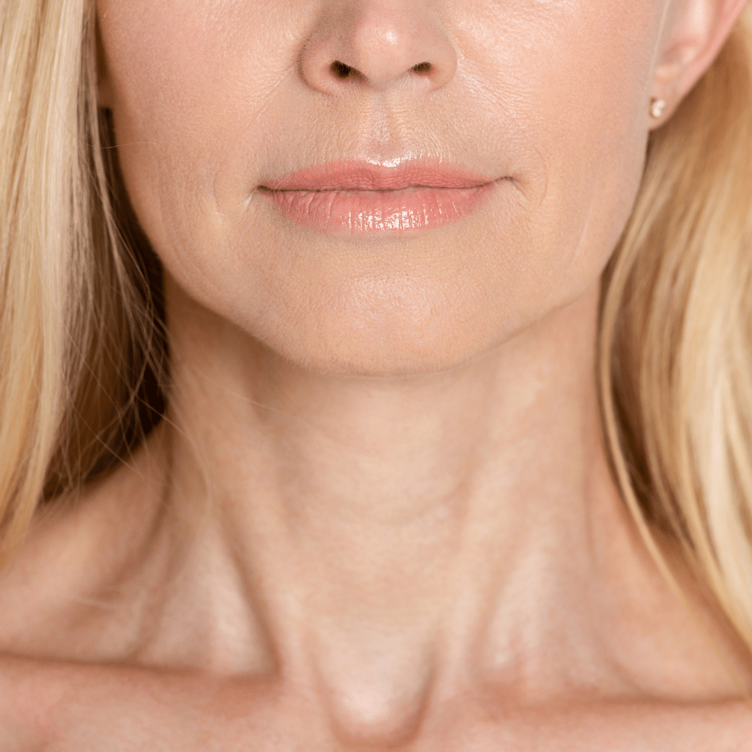 Smooths Mouth Wrinkles & Hard Lines